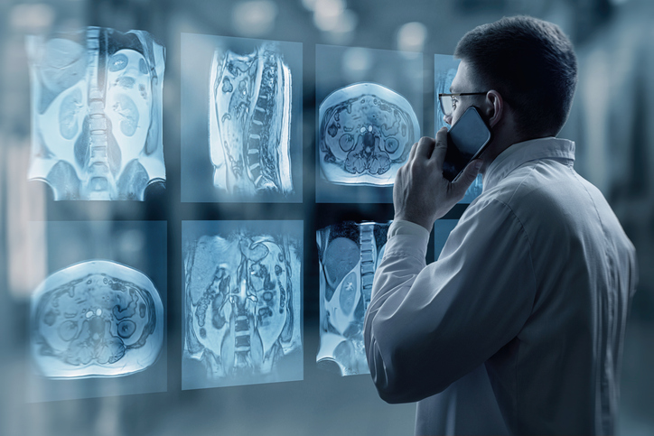 Top Artificial Intelligence Trends Influencing The Future Of Radiology 